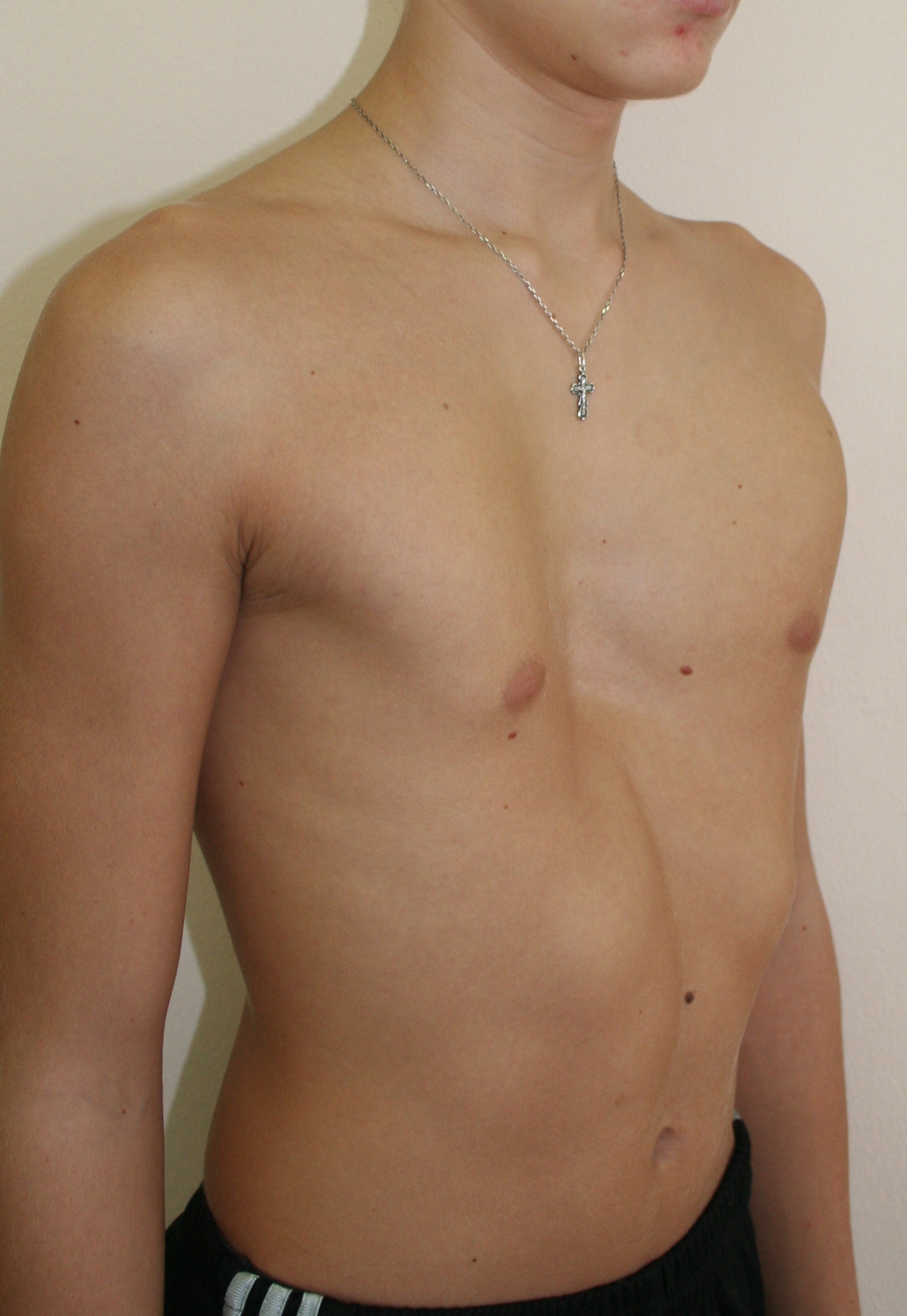 ямки на груди у мужчин фото 12